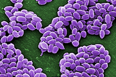  The CIA has long been concerned biological threats, including the use of anthrax bacteria, seen above.   © Reuters 